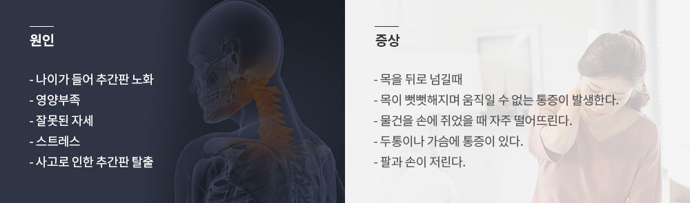 목 디스크 원인 증상