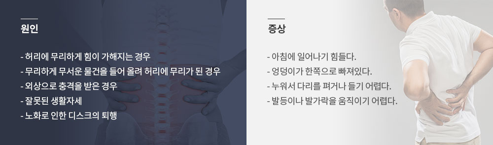 허리 디스크 원인 증상